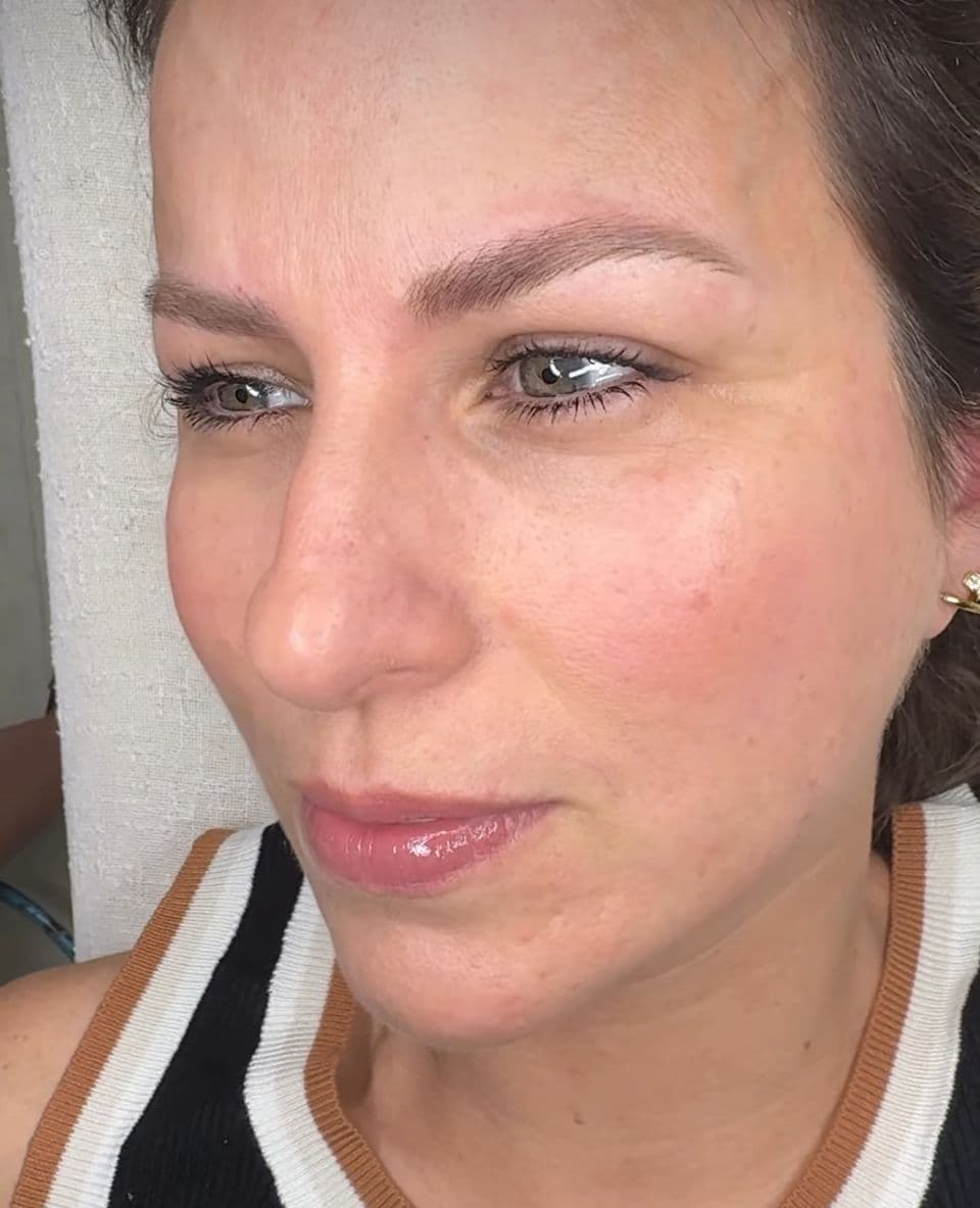 Dermo en cejas - Imagen 4