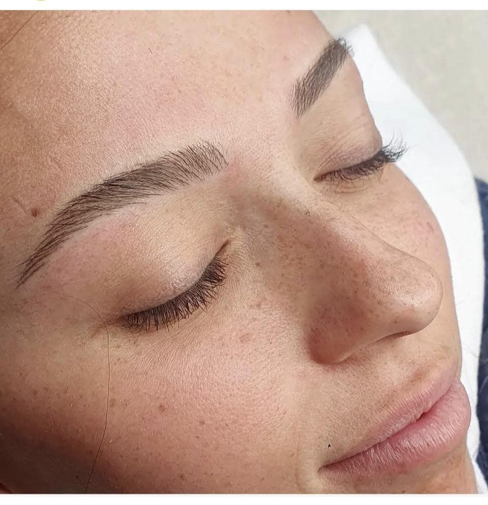 Dermo en cejas - Imagen 5