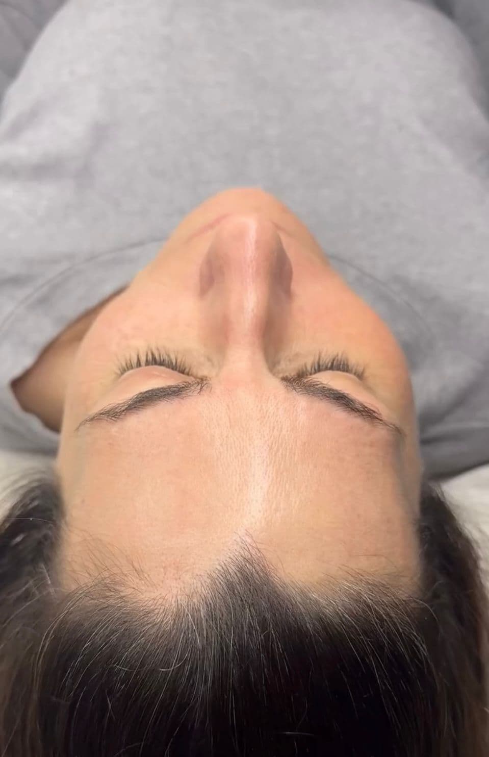 Skincare y peelings - Imagen 2