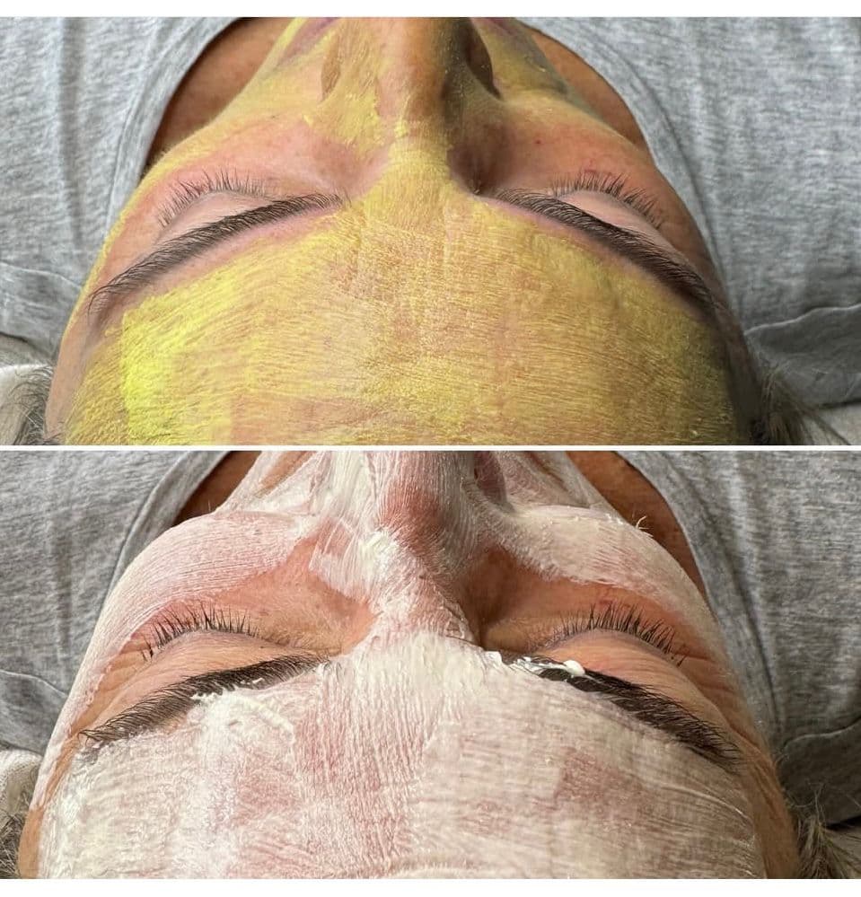 Skincare y peelings - Imagen 7